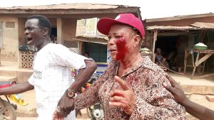 Many Injured as Violence Erupts at APC Ward Congress in Oluyole